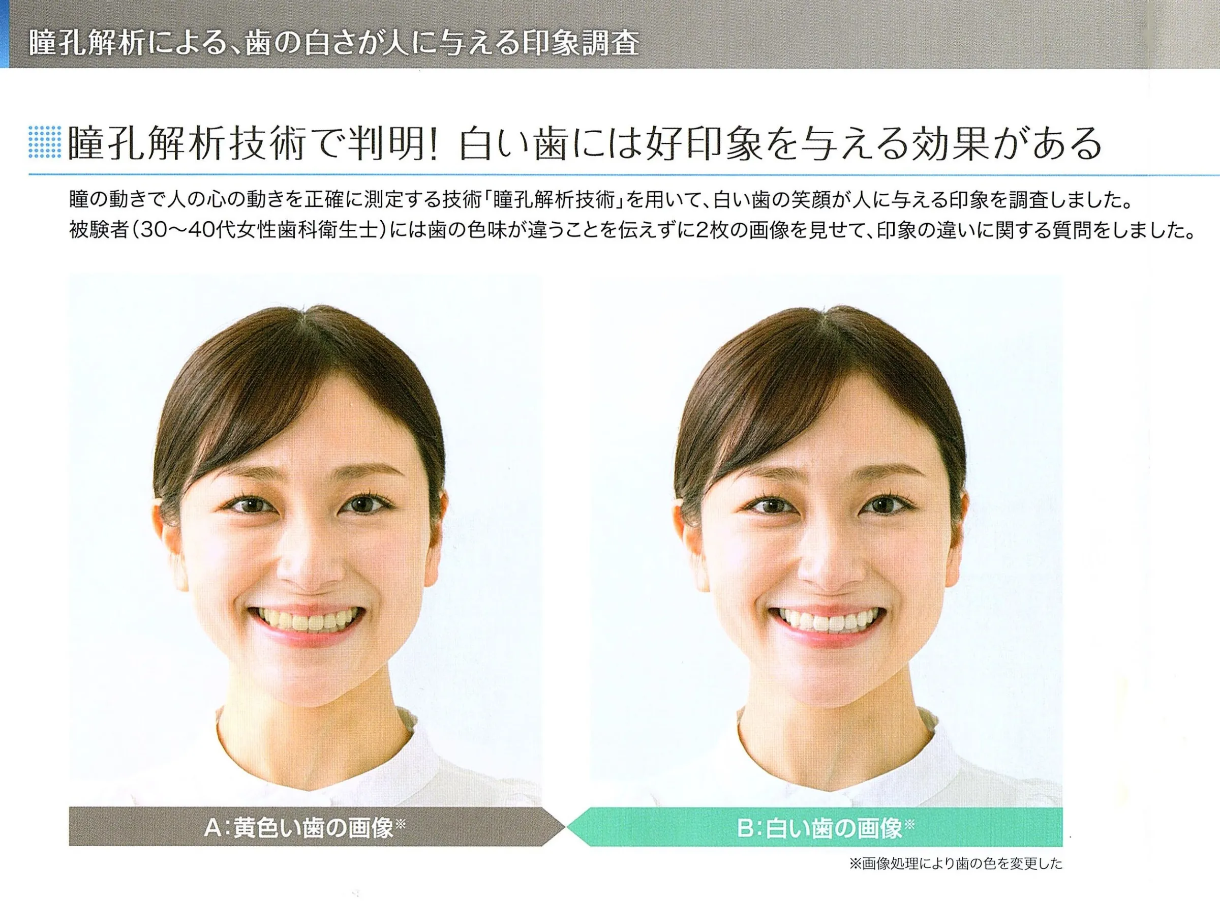 瞳孔解析技術で判明!白い歯には好印象を与える効果がある