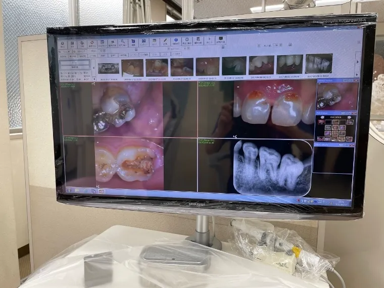 デジタル診断説明用モニター
