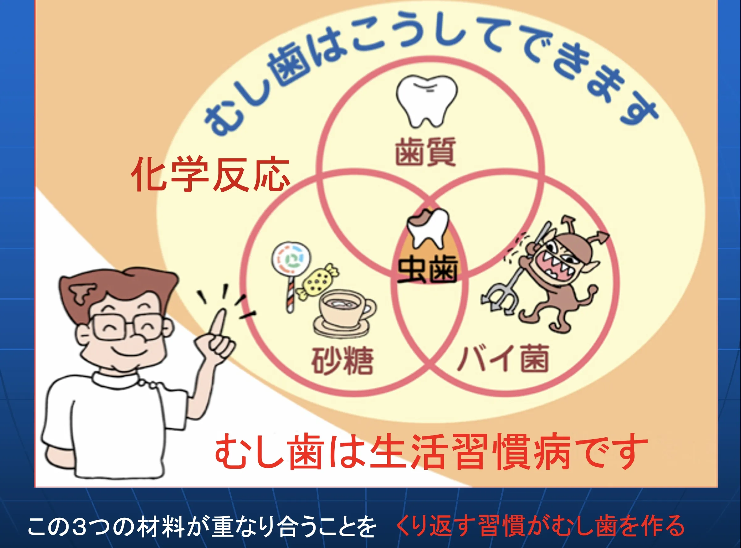 むし歯ができる原因を説明した教育ポスター。歯質・砂糖・バイ菌の3要素が重なり合うベン図と虫歯のイラストを中心に、虫歯のメカニズムを視覚的に解説。